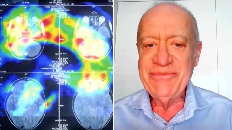 Experte verrät "Masterplan gegen Demenz"