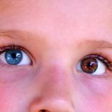Kind mit verschieden farbigen Augen
