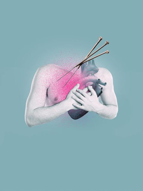Illustration Brust, Herz und Akupunkturnadeln