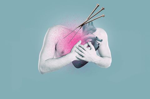 Illustration Brust, Herz und Akupunkturnadeln