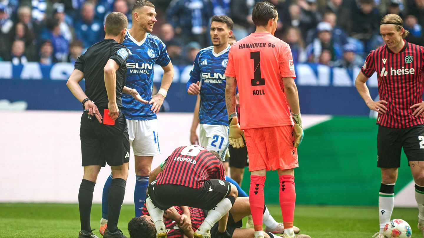 Nachdem er den Hannoveraner Husseyn Chakroun mit dem hohen Fuß getroffen hatte, wurde Edin Dzeko des Feldes verwiesen. Foto: Ber