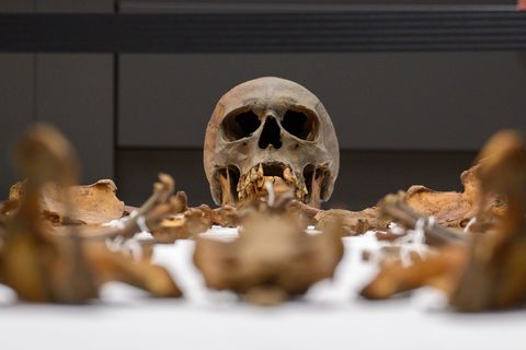 Dem Kaiser fehlten unter anderem drei obere Schneidezähne. Foto: Klaus-Dietmar Gabbert/dpa