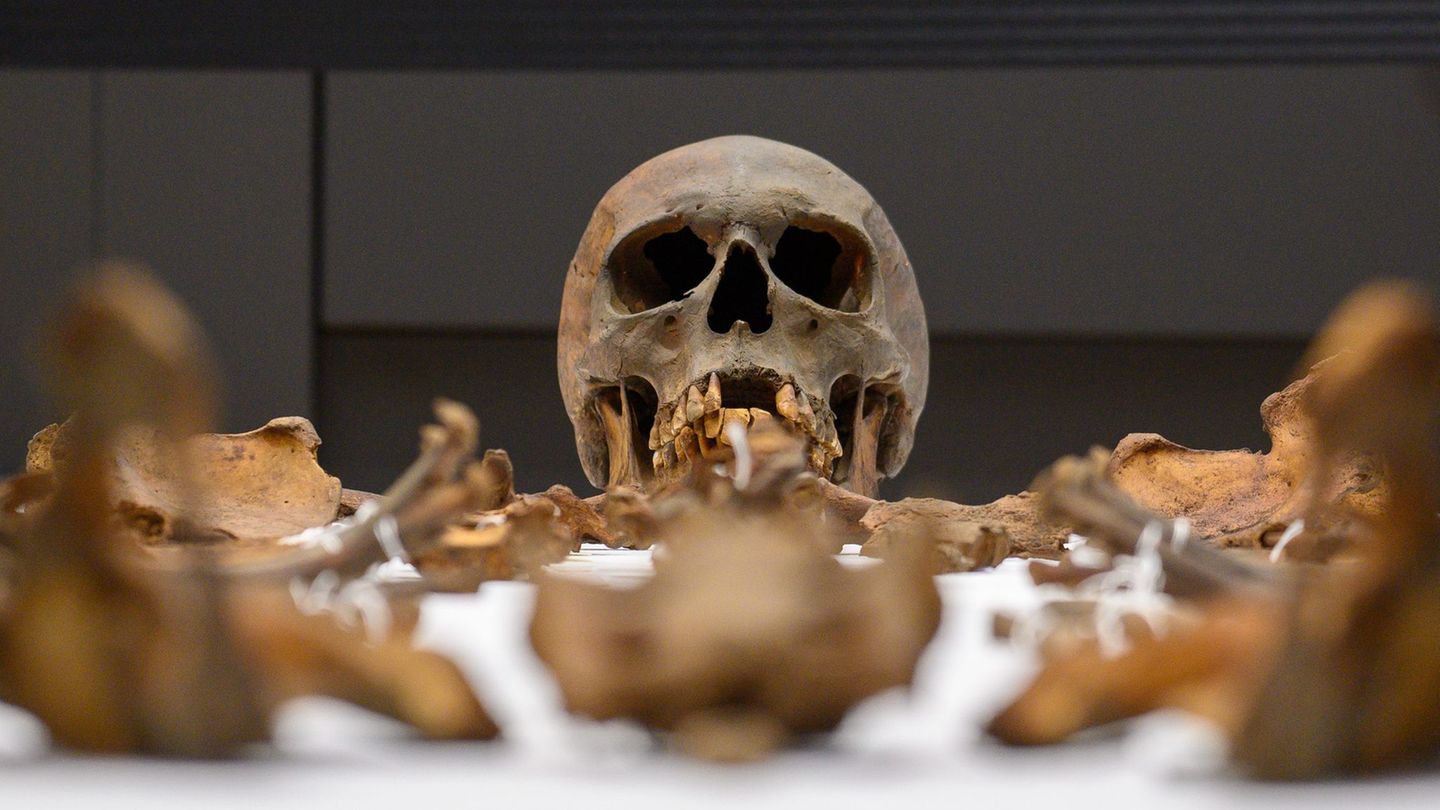 Dem Kaiser fehlten unter anderem drei obere Schneidezähne. Foto: Klaus-Dietmar Gabbert/dpa