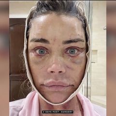Circa 200.000 Dollar: Denise Richards zeigt online neues Gesicht