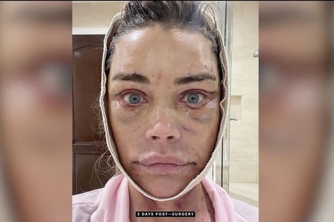 Circa 200.000 Dollar: Denise Richards zeigt online neues Gesicht