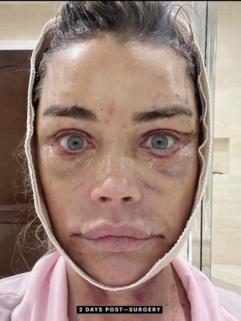 Circa 200.000 Dollar: Denise Richards zeigt online neues Gesicht