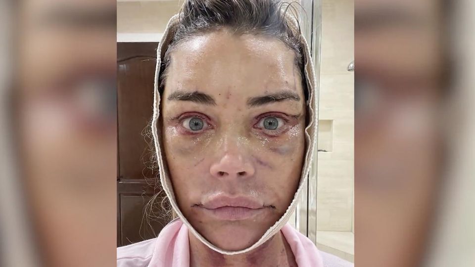 Circa 200.000 Dollar: Denise Richards zeigt online neues Gesicht