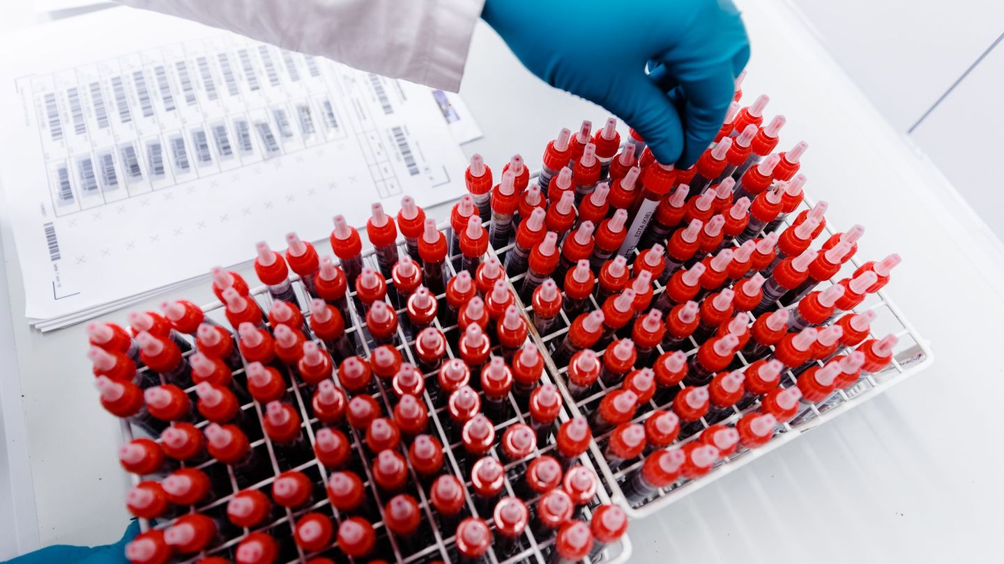 Wissenschaft: Halle baut Kryolager aus – Millionen für Forschung an Proben