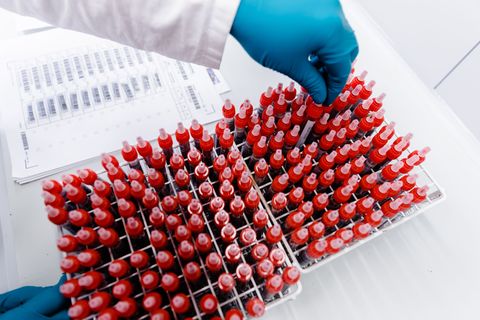 Blut- und Gewebeproben werden in Halle bei extrem niedrigen Temperaturen gelagert. (Symbolbild) Foto: picture alliance / Markus