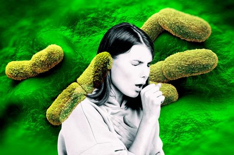 Montage zeigt hustende Frau vor Pestbakterien
