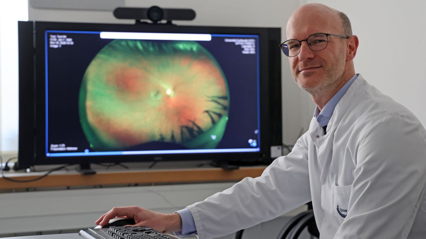 Als eine Art Fenster zum Körper kann die Netzhaut Hinweise auf Krankheiten und gesundheitliche Risiken jenseits der Augen liefer