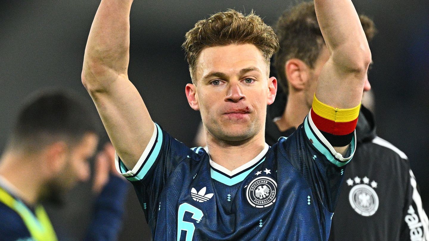 Joshua Kimmich feiert mit einer Verletzung an der Lippe den Sieg in der Schweiz. Foto: Tom Weller/dpa