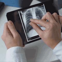 Lungenkrebs-Screening