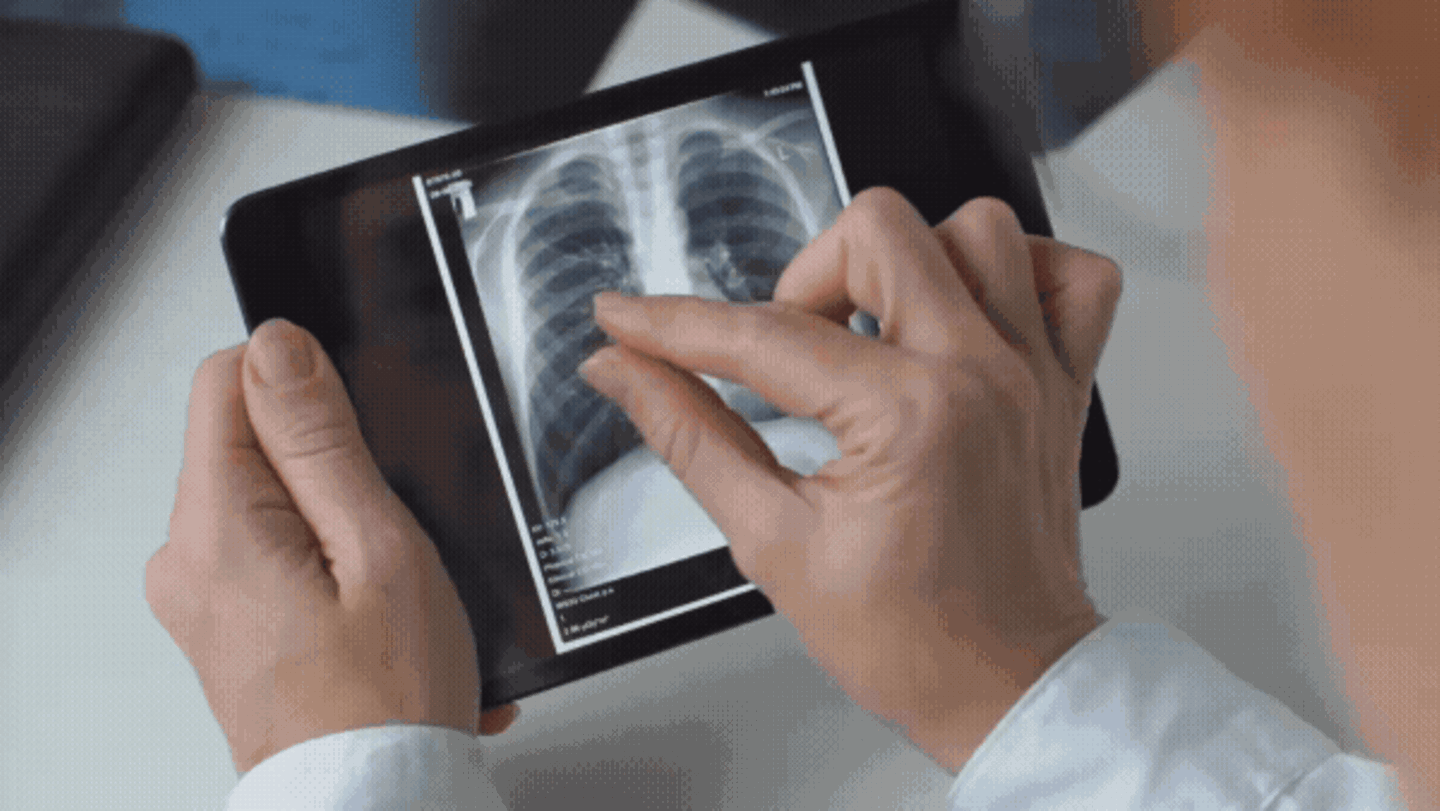 Krebsprävention: Was Raucher und Ex-Raucher über das neue Lungenkrebs-Screening wissen sollten