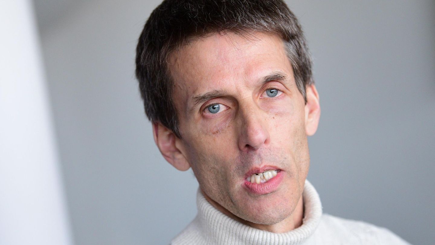 Wal vor Wismar: Meeresforscher erklärt, was "Irrläufer" in die Ostsee treibt