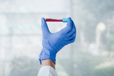 Eine Hand hält eine Phiole mit Blut hoch