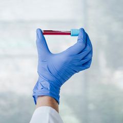 Eine Hand hält eine Phiole mit Blut hoch