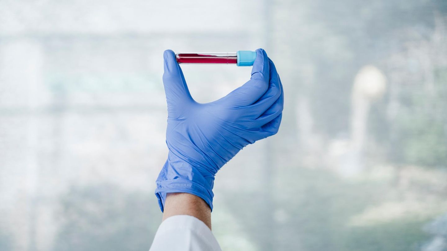 Eine Hand hält eine Phiole mit Blut hoch