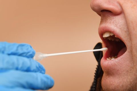 DNA-Test auch bei Zwillingen