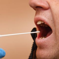 DNA-Test auch bei Zwillingen