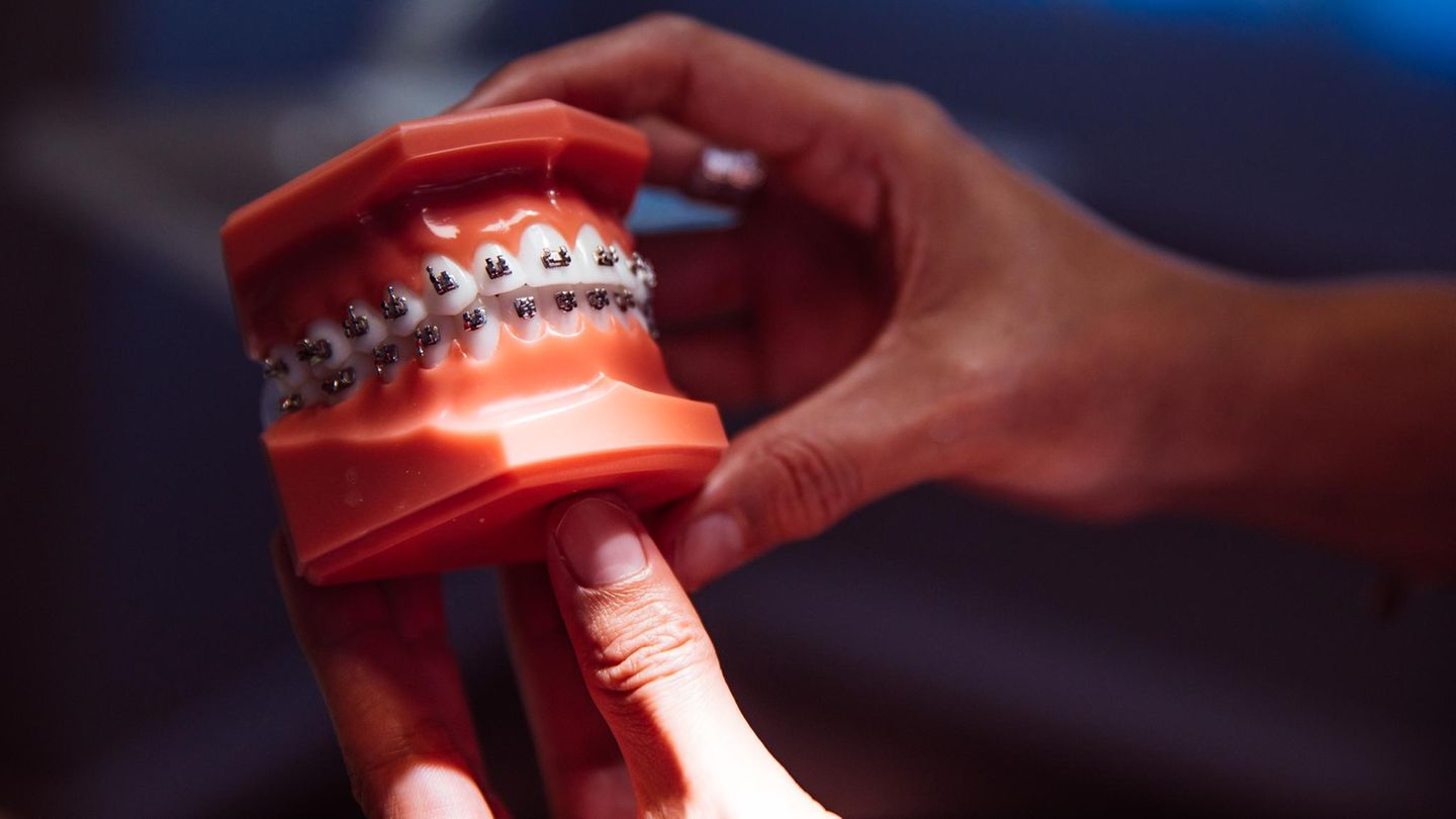 Zahnspange am Modell