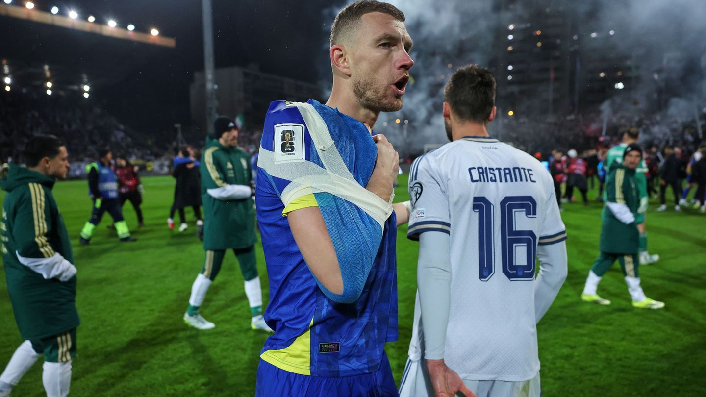 Edin Dzeko wurde direkt verarztet. Foto: Armin Durgut/AP/dpa