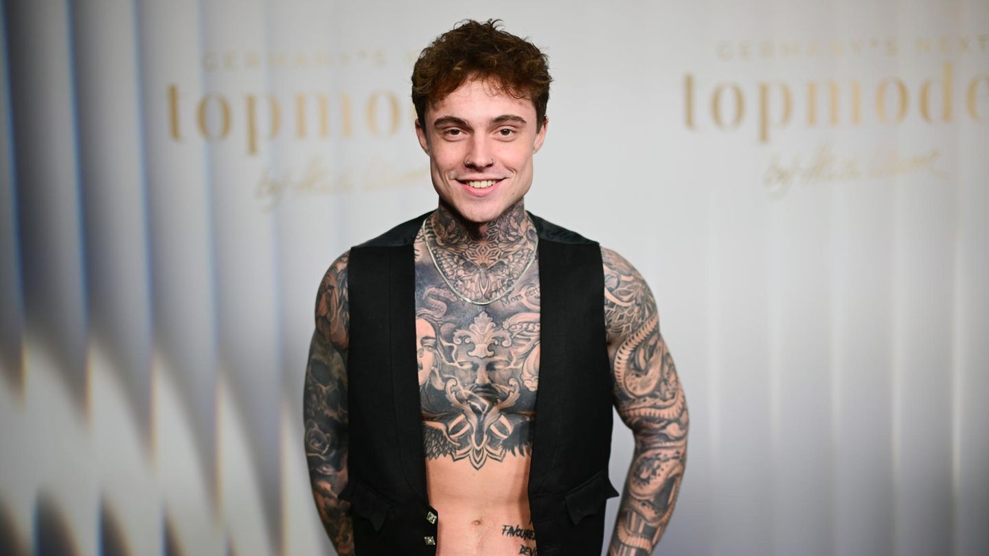 Darmverdrehung: „GNTM“-Model Samuel Dohmen nach Not-OP auf Intensivstation