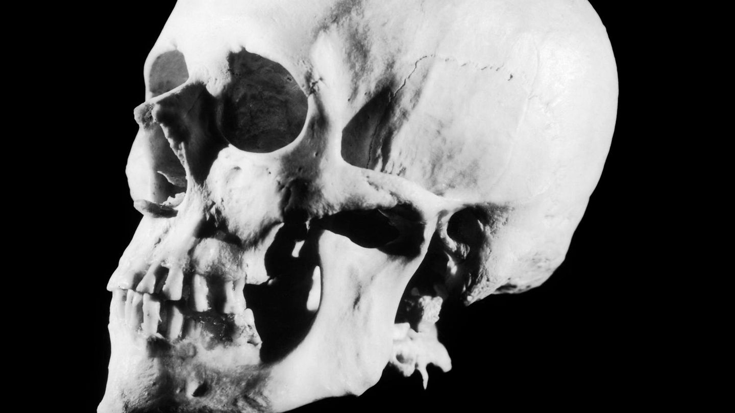 Münsterland: Radfahrer macht gruseligen Fund: Schädel treibt im Wasser