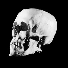 In der Stadt Rheine im Münsterland wurde ein menschlicher Totenschädel entdeckt (Symbolbild)