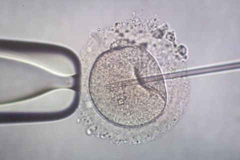 Die künstliche Befruchtung ist eine Möglichkeit für ungewollt kinderlose Paare. (Symbolbild) Foto: Focke Strangmann/dpa