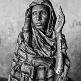 Frau zeigt Narben an ihrem Arm