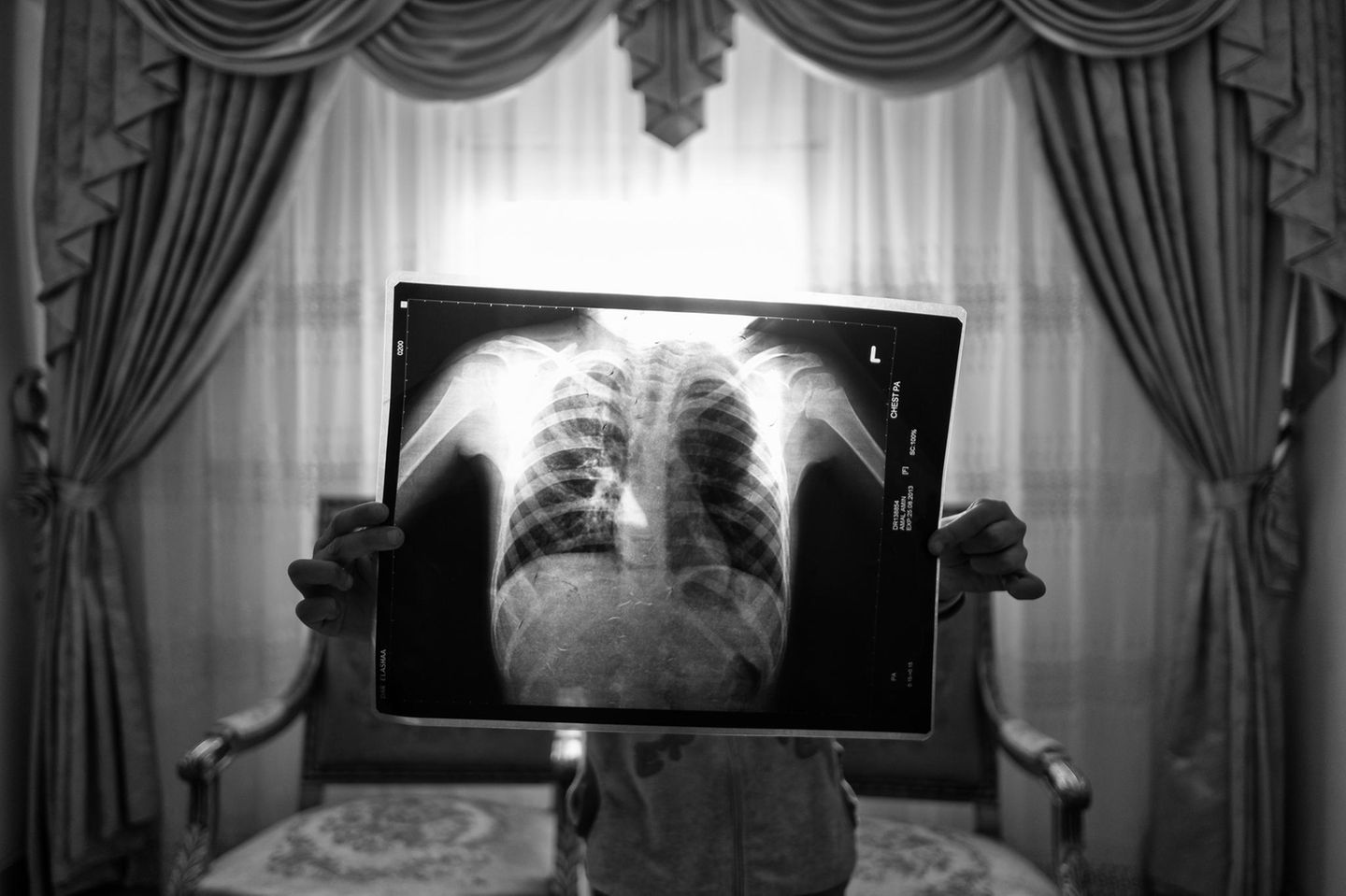 Person hält Röntgenbild in die Höhe