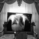 Person hält Röntgenbild in die Höhe