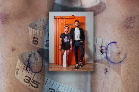 Collage zu Beinverlängerung