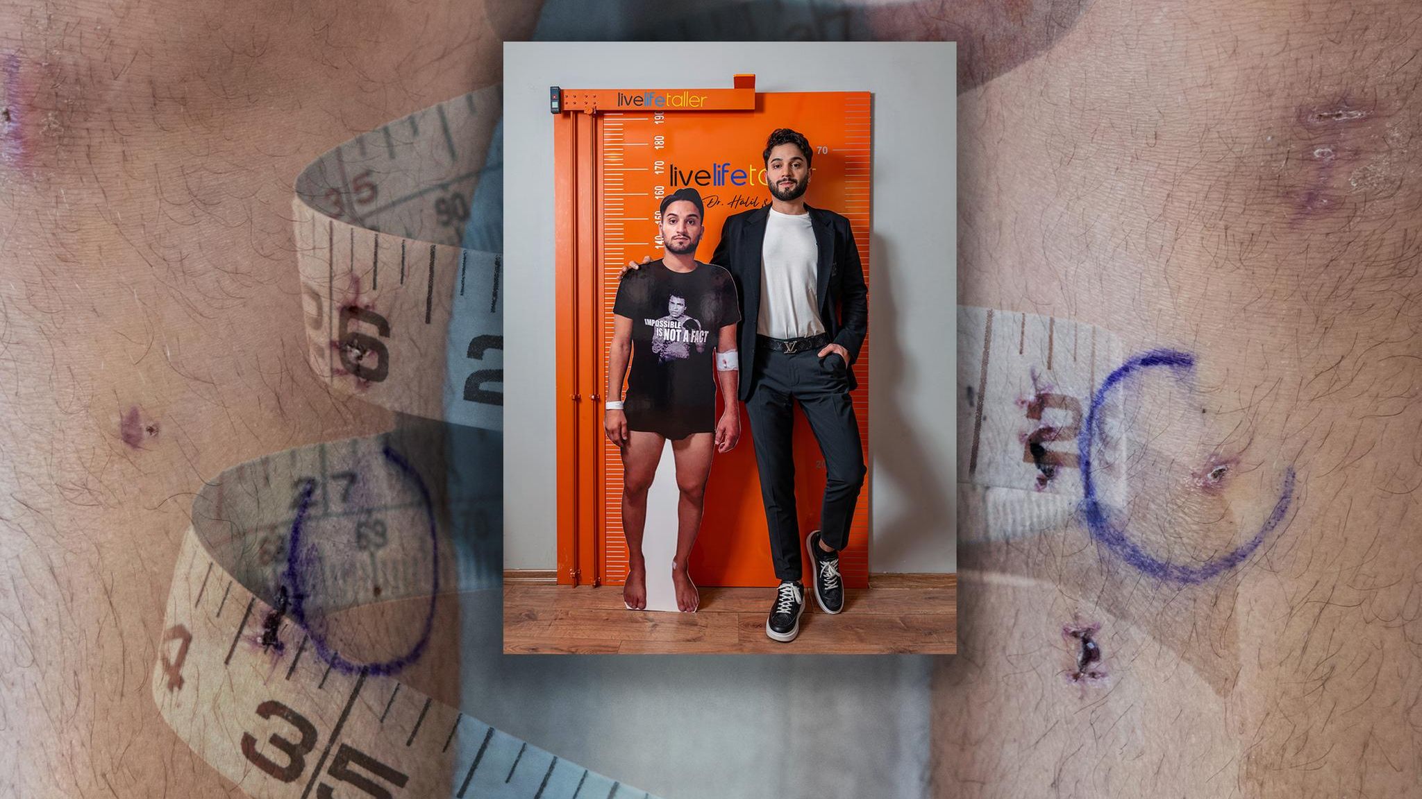 Collage zu Beinverlängerung