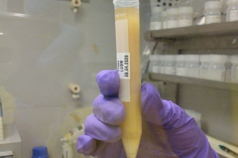 Die verdächtige Substanz - hier ist eine Probe davon zu sehen - wird nun noch weiter von Experten untersucht. Foto: Umweltminist