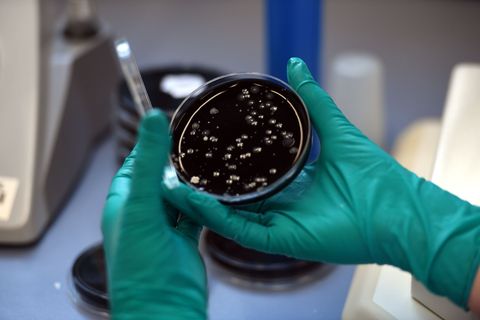 Nach einem Legionellen-Ausbruch in Ulm sind zwei Menschen gestorben. (Symbolbild) Foto: picture alliance / dpa