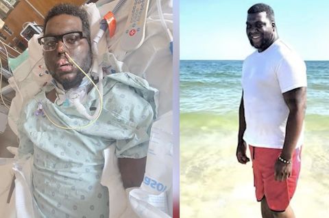 Zahnbehandlung führt zu Blutvergiftung – 34-Jähriger verliert Extremitäten