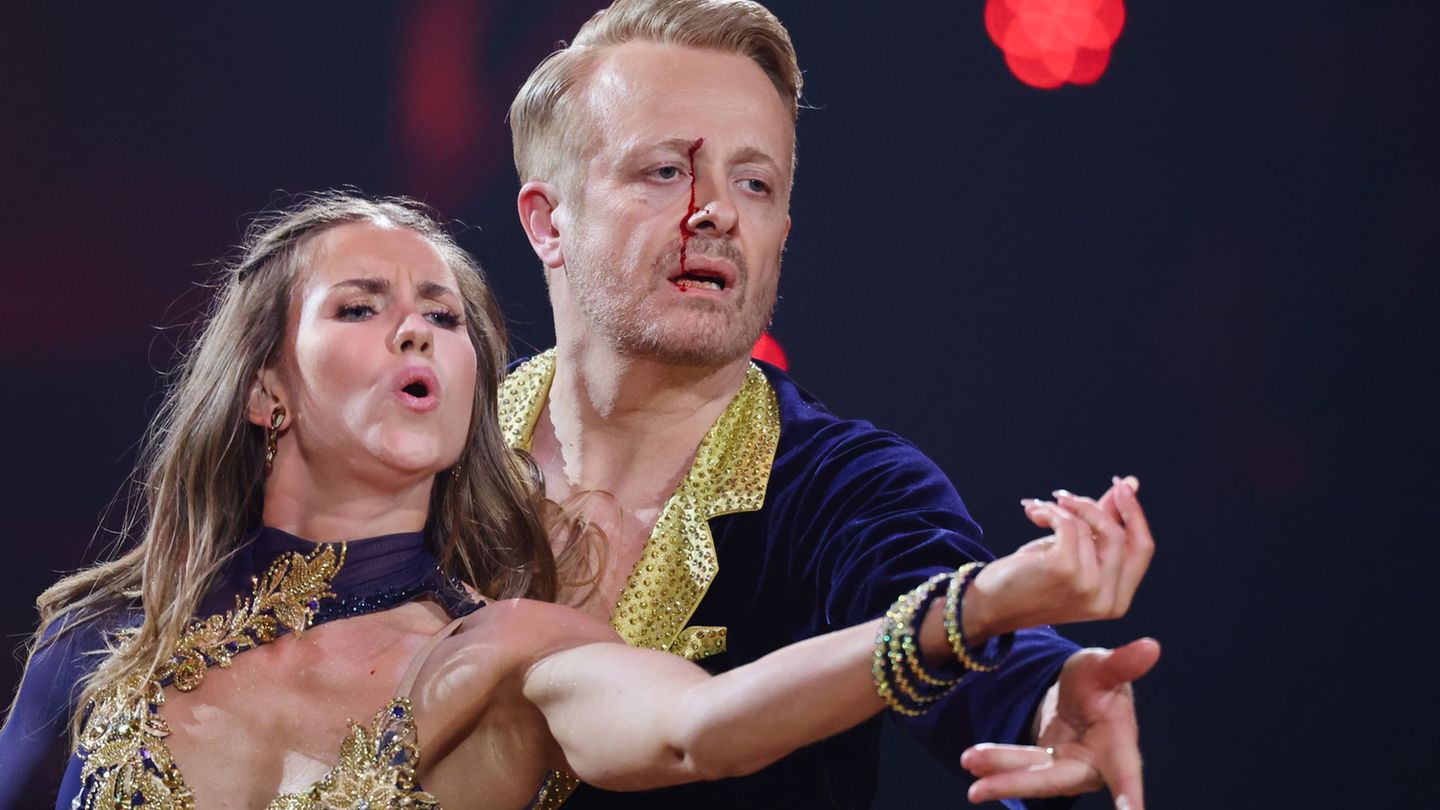 Fernsehen: Ross Antony blutet bei "Let's Dance" – und macht weiter