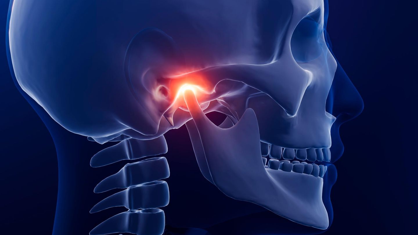 Kieferschmerz: Illustration Schädel mit schmerzendem Kiefergelenk