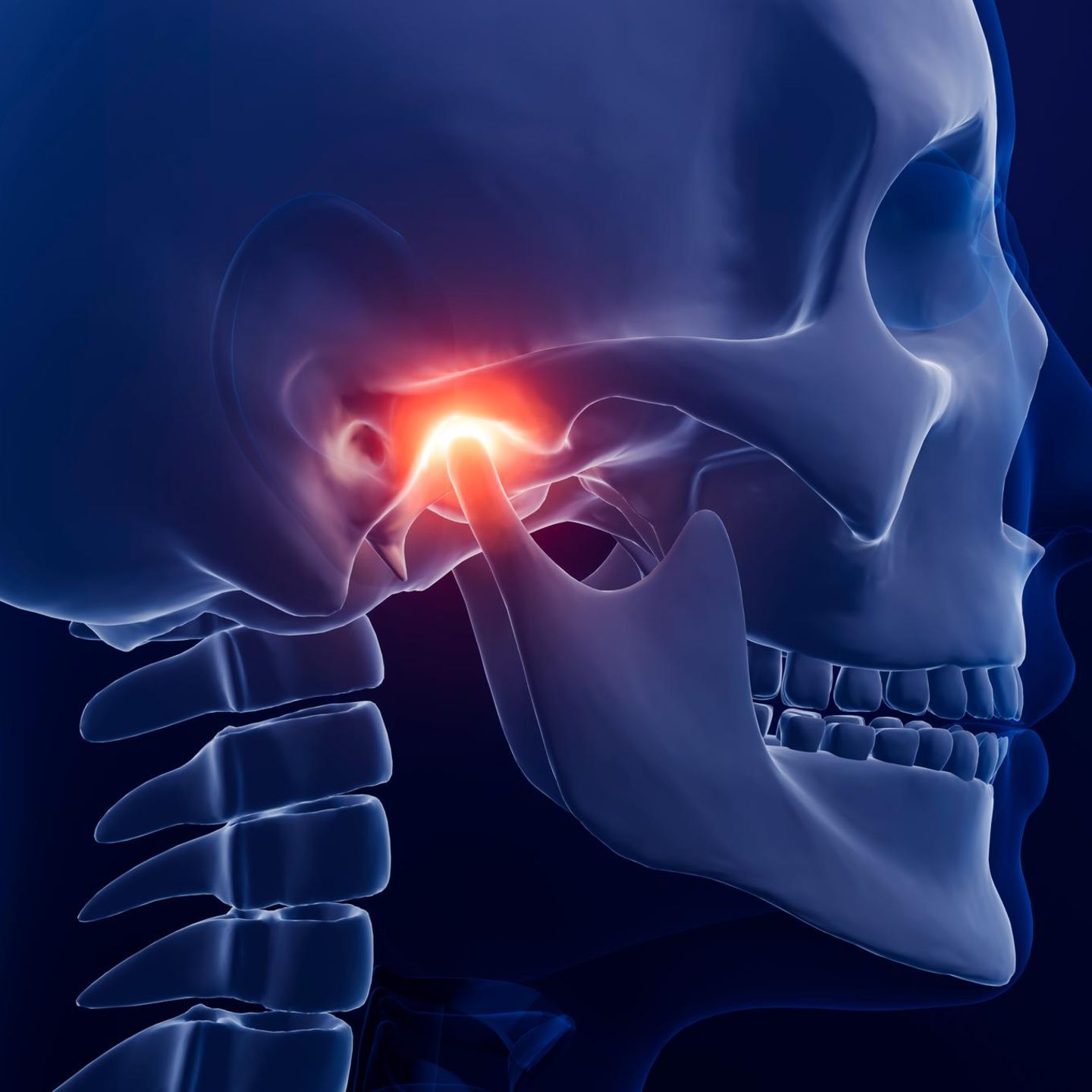 Kieferschmerz: Illustration Schädel mit schmerzendem Kiefergelenk
