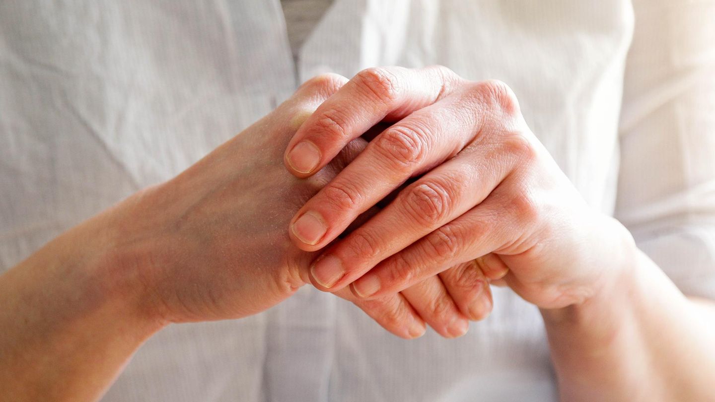 Handekzem: Eine Person reibt sich die Hände, die Haut ist gerötet