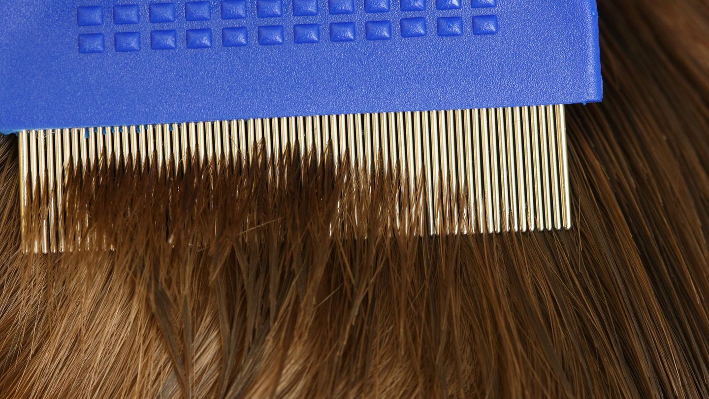 Die AOK registrierte weniger Verordnungen von Mitteln gegen Läusebefall. Foto: Patrick Pleul/dpa