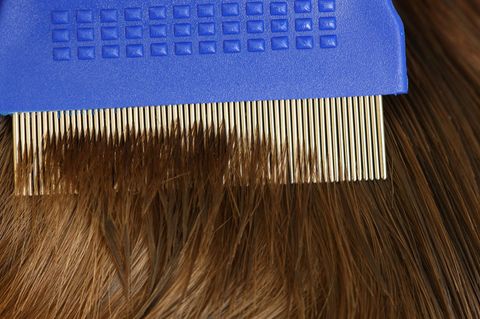 Die AOK registrierte weniger Verordnungen von Mitteln gegen Läusebefall. Foto: Patrick Pleul/dpa