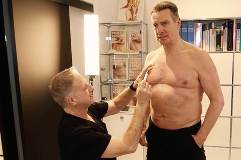 Jürgen Milski zeigt Schönheits-OP