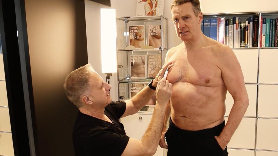 Jürgen Milski zeigt Schönheits-OP