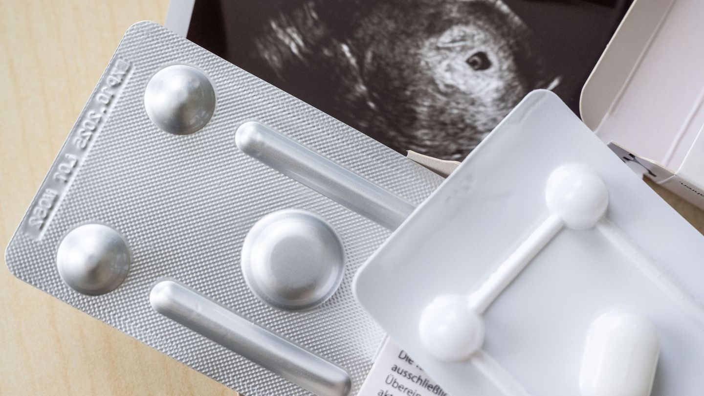 Statistik: Erstmals mehr Abtreibungen mit Medikamenten als mit OP