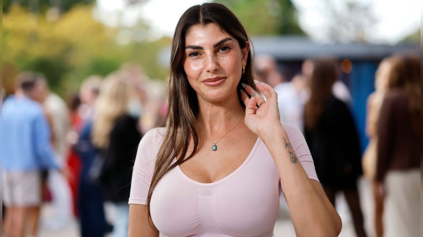 "Überlegt euch das gut": Yeliz Koc bereut Schönheits-OP