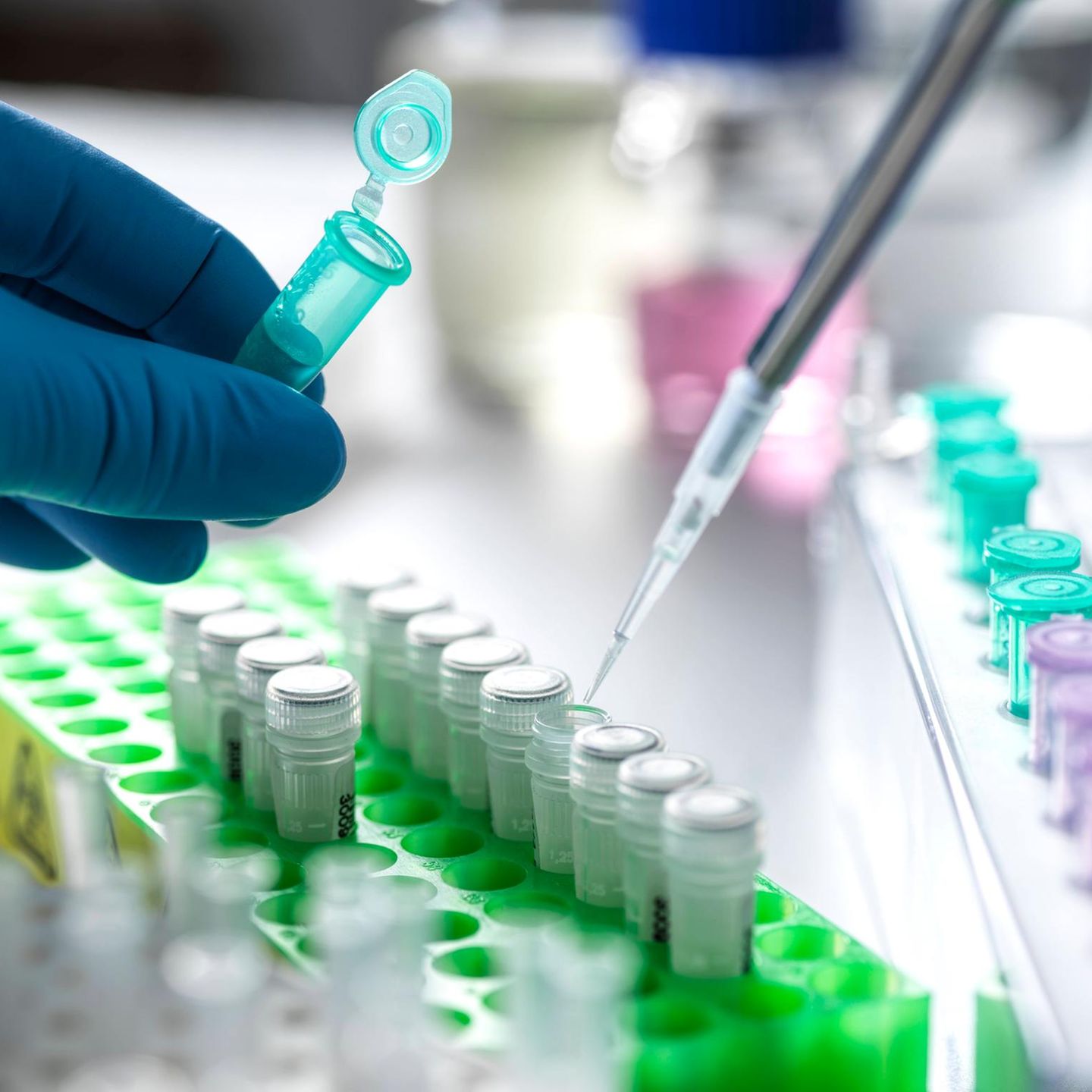 DNA Probe in einem Labor