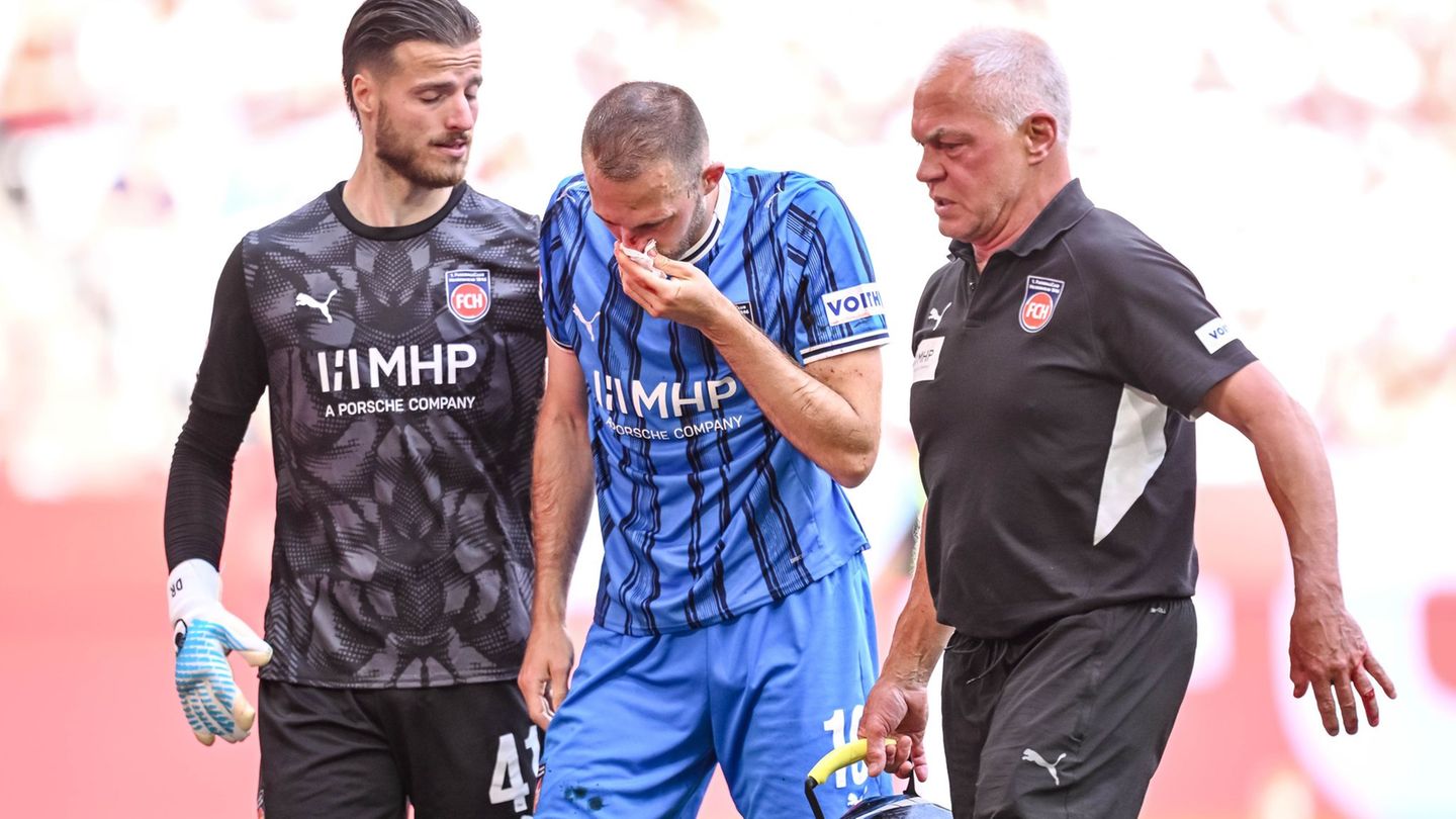 Fußball-Bundesliga: Nasenbeinbruch bei Heidenheims Föhrenbach
